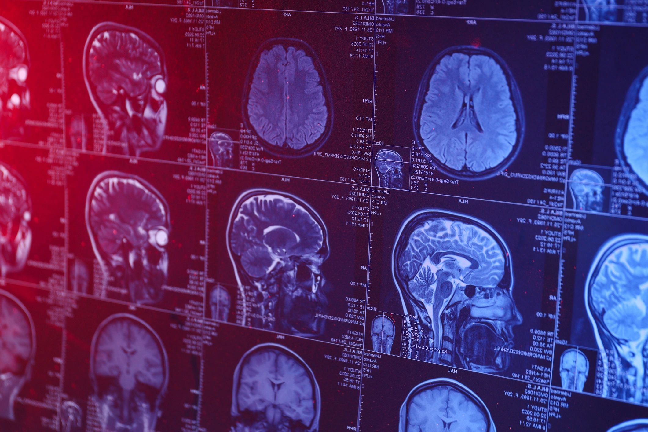 MRI machine